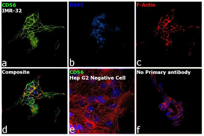 Engine Cd56 CD56 Monoclonal Antibody (123C3) | Invitrogen (MA1-06801)