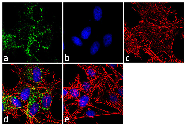 NF1 Antibody in Immunocytochemistry (ICC/IF)