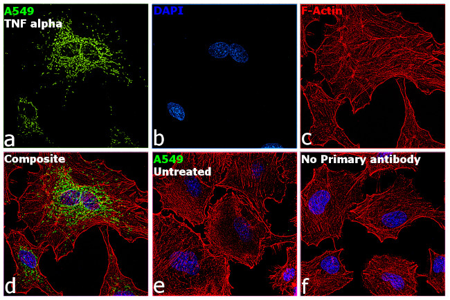 SOD2 Antibody in Immunocytochemistry (ICC/IF)