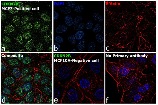 CDKN2B Antibody in Immunocytochemistry (ICC/IF)
