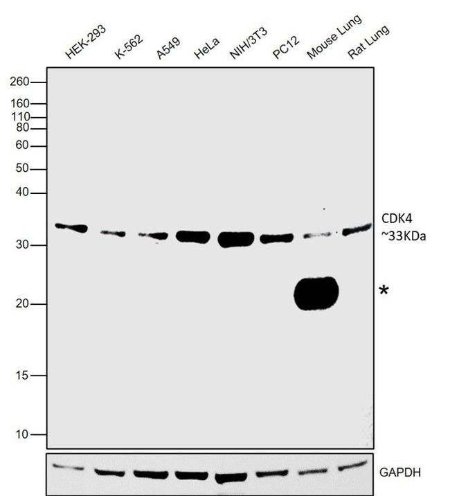 CDK4 Antibody in Western Blot (WB)