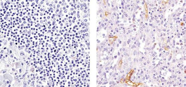VCAM-1 Antibody in Immunohistochemistry (Paraffin) (IHC (P))