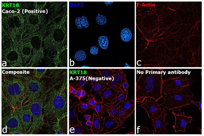 Cytokeratin 18 Antibody in Immunocytochemistry (ICC/IF)