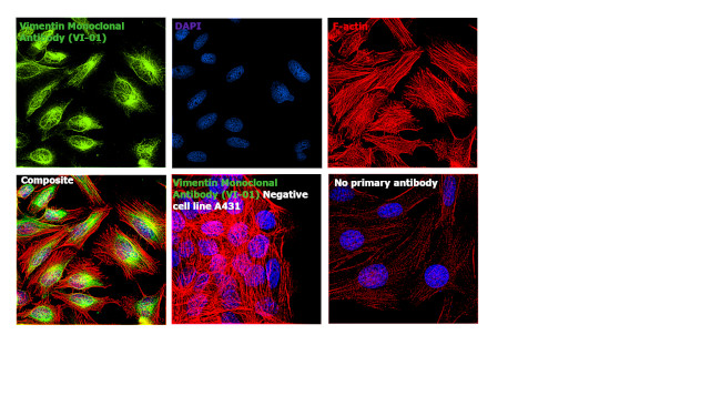 Vimentin Antibody in Immunocytochemistry (ICC/IF)