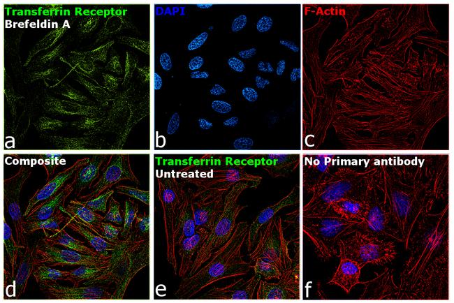 Transferrin Receptor Monoclonal Antibody (MEM-189) (MA1-19299)