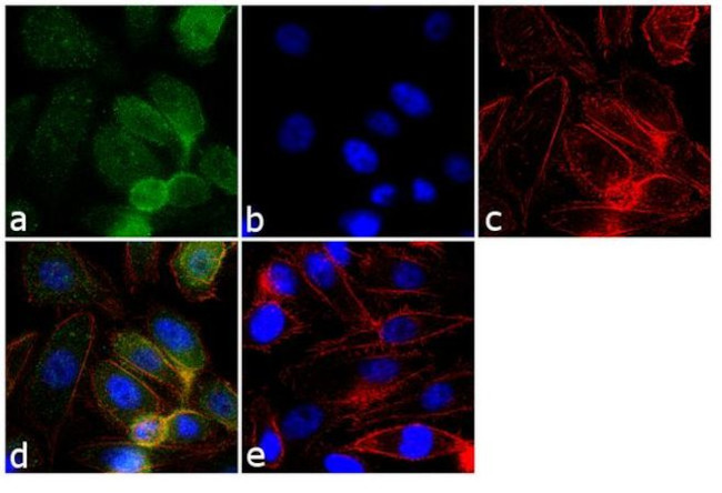 GRK2 Antibody in Immunocytochemistry (ICC/IF)