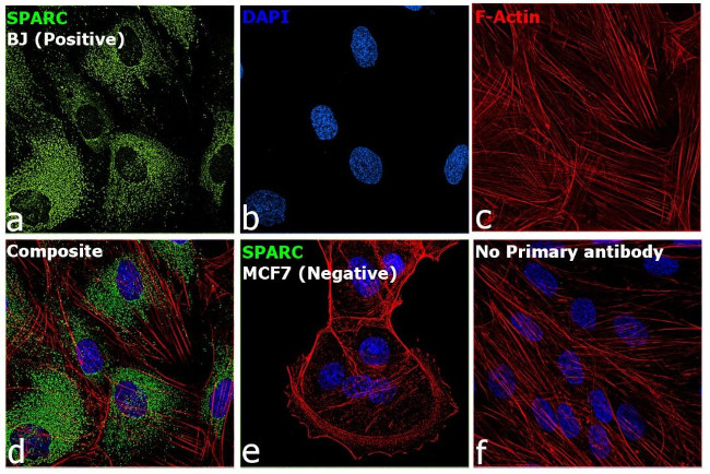 SPARC Antibody in Immunocytochemistry (ICC/IF)