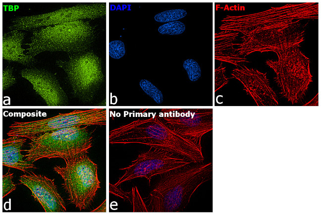 TBP Antibody in Immunocytochemistry (ICC/IF)