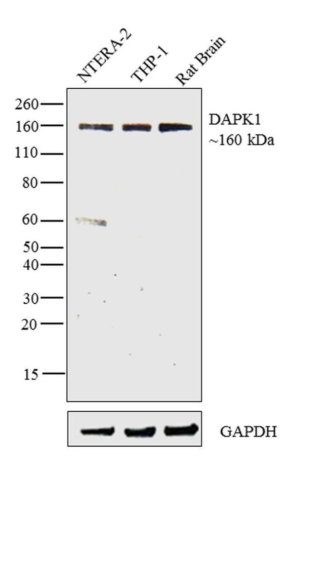 DAPK1 Antibody in Western Blot (WB)