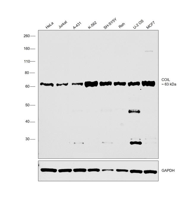 Coilin Antibody in Western Blot (WB)