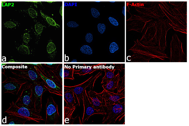 LAP2 Antibody in Immunocytochemistry (ICC/IF)