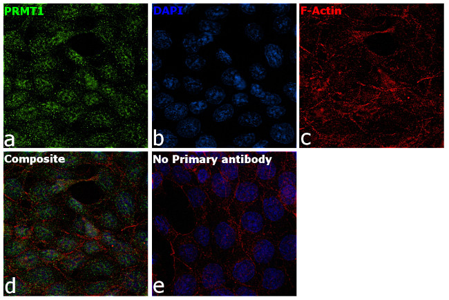 PRMT1 Antibody in Immunocytochemistry (ICC/IF)