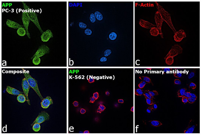 Amyloid Precursor Protein Antibody in Immunocytochemistry (ICC/IF)