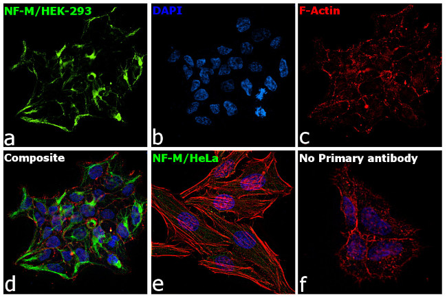 NEFM Antibody in Immunocytochemistry (ICC/IF)