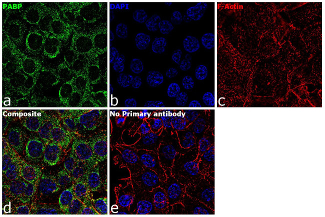 PABP Antibody in Immunocytochemistry (ICC/IF)