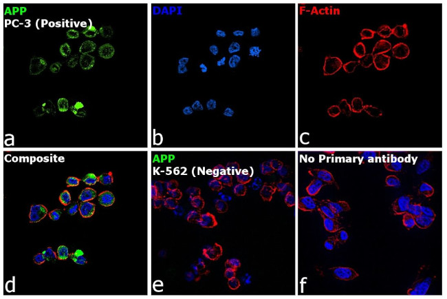 beta Amyloid Antibody in Immunocytochemistry (ICC/IF)