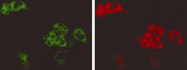 6x-His Tag Antibody in Immunocytochemistry (ICC/IF)
