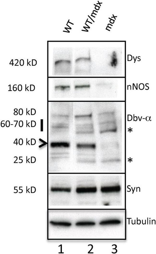 nNOS Antibody in Western Blot (WB)