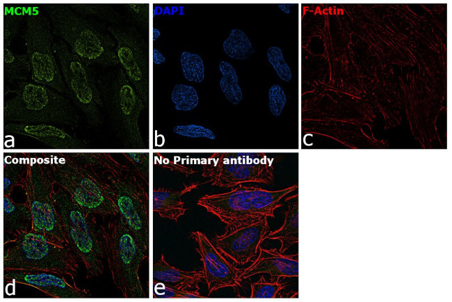 MCM5 Antibody in Immunocytochemistry (ICC/IF)
