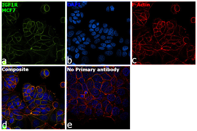 IGF1R (CD221) Antibody in Immunocytochemistry (ICC/IF)