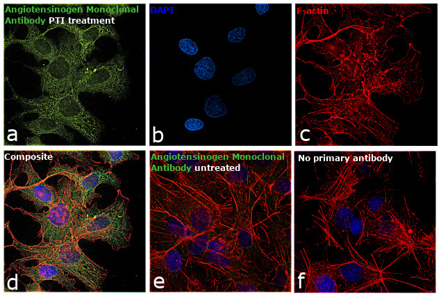 Angiotensin I Antibody in Immunocytochemistry (ICC/IF)