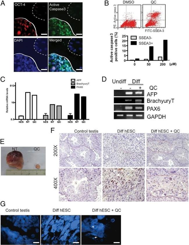 Nuclear Membrane Antibody in Immunohistochemistry (IHC)