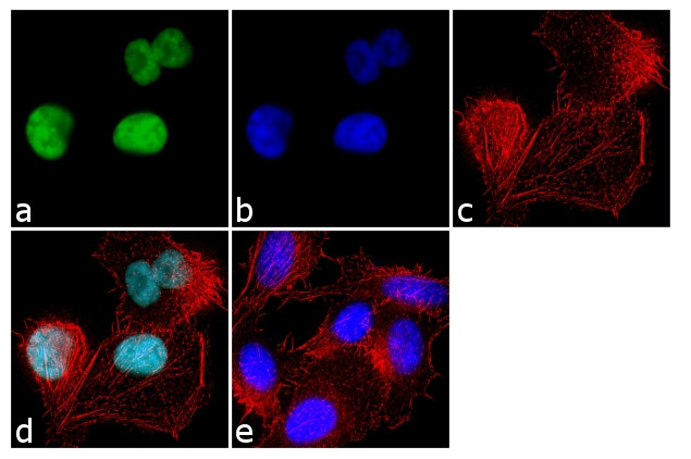 NCoR2 Antibody in Immunocytochemistry (ICC/IF)