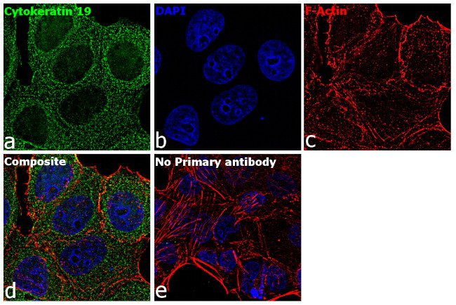 Cytokeratin 19 Antibody in Immunocytochemistry (ICC/IF)