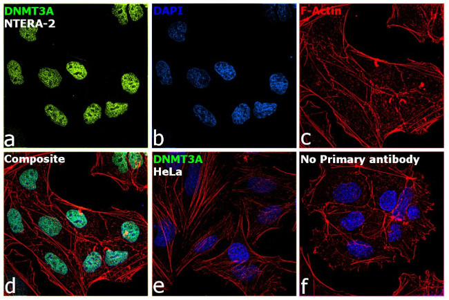 DNMT3A Antibody in Immunocytochemistry (ICC/IF)