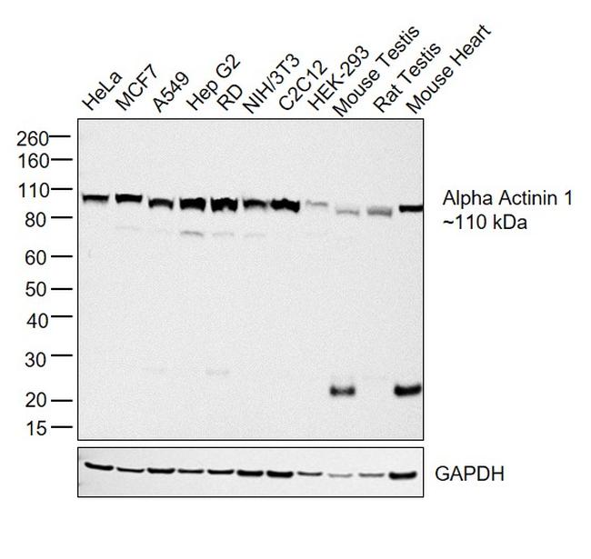 alpha Actinin 1 Antibody in Western Blot (WB)