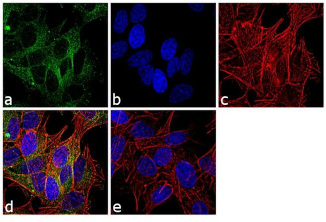 beta-3 Tubulin Antibody in Immunocytochemistry (ICC/IF)