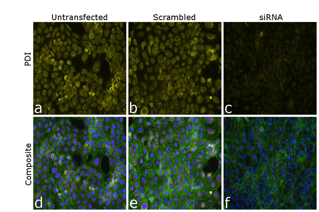 PDI Antibody in Immunocytochemistry (ICC/IF)