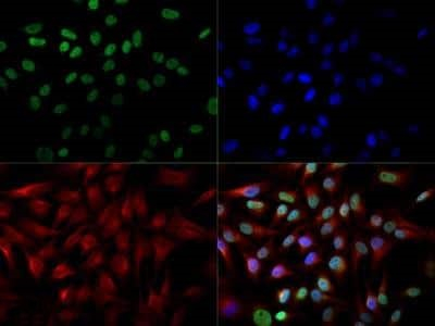 CITED2 Antibody in Immunocytochemistry (ICC/IF)