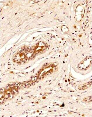 BRIP1 Antibody in Immunohistochemistry (Paraffin) (IHC (P))