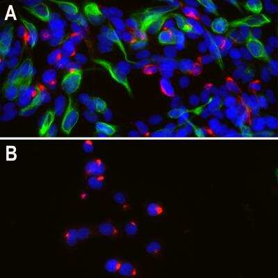 Peripherin Antibody in Immunocytochemistry (ICC/IF)