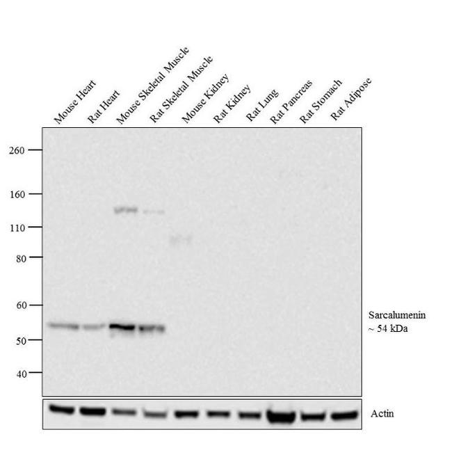 Sarcalumenin Antibody in Western Blot (WB)