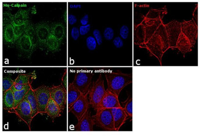 Mu-Calpain Antibody in Immunocytochemistry (ICC/IF)