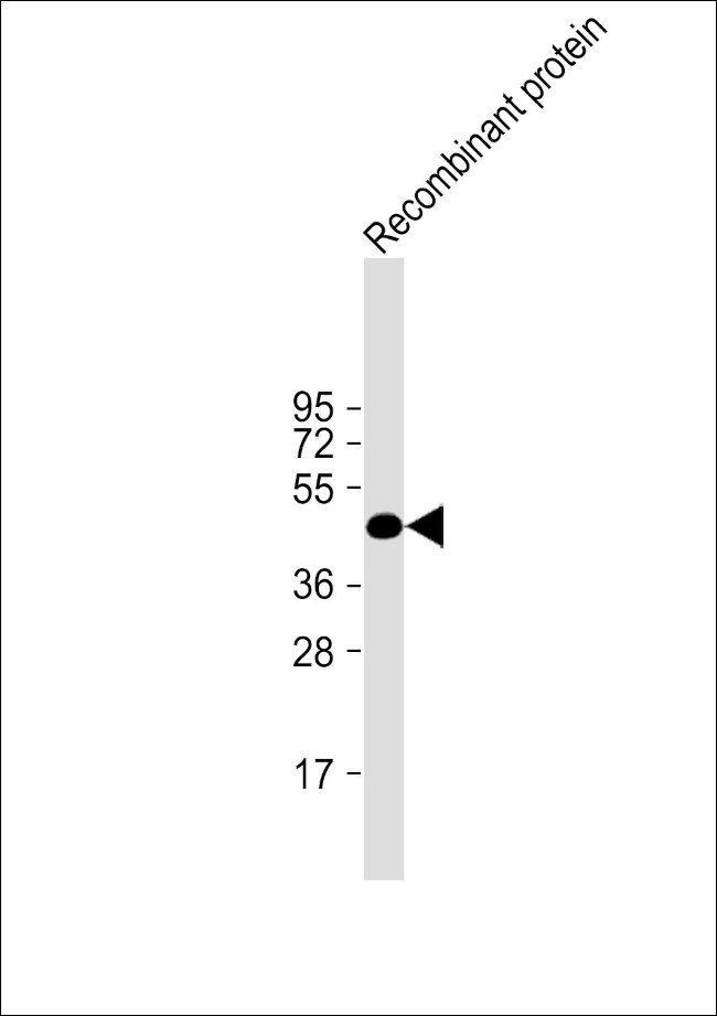 Vaccinia Virus H1L Antibody in Western Blot (WB)