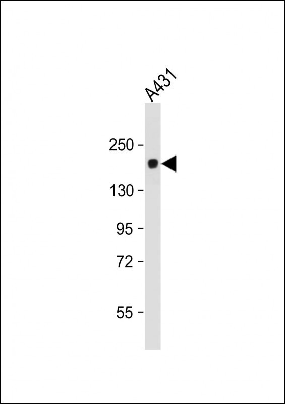 PRDM10 Antibody in Western Blot (WB)
