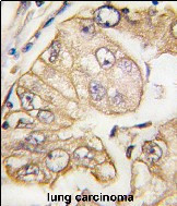 VEGF Receptor 3 Antibody in Immunohistochemistry (Paraffin) (IHC (P))