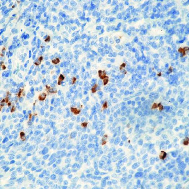 Human IgA (Heavy chain) Secondary Antibody in Immunohistochemistry (Paraffin) (IHC (P))