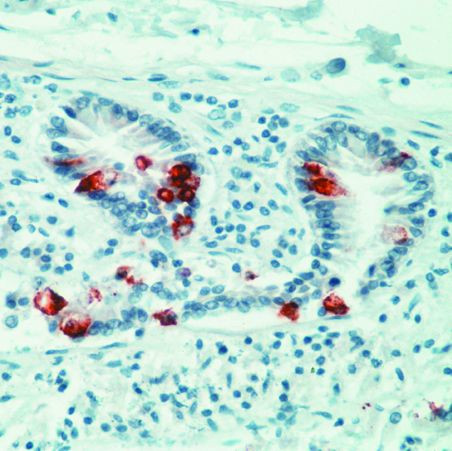 MUC2 Antibody in Immunohistochemistry (Paraffin) (IHC (P))