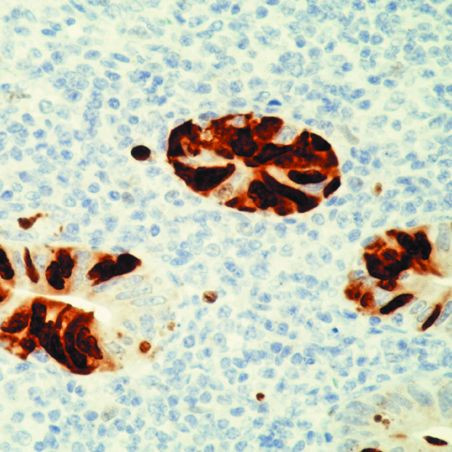 Adenovirus Type 2/5 Antibody in Immunohistochemistry (Paraffin) (IHC (P))