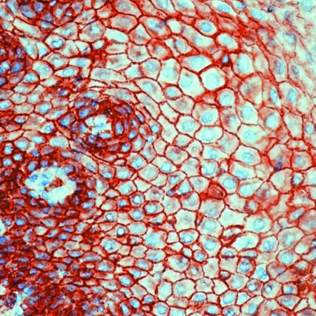 CD9 Antibody in Immunohistochemistry (IHC)