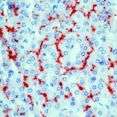 CD13 Antibody in Immunohistochemistry (IHC)