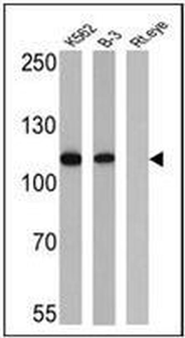 Rb Antibody in Western Blot (WB)