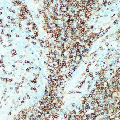CD22 Antibody in Immunohistochemistry (IHC)