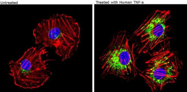 VCAM-1 Antibody in Immunocytochemistry (ICC/IF)