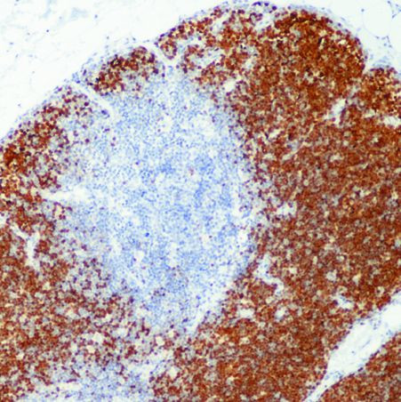 TdT Antibody in Immunohistochemistry (Paraffin) (IHC (P))