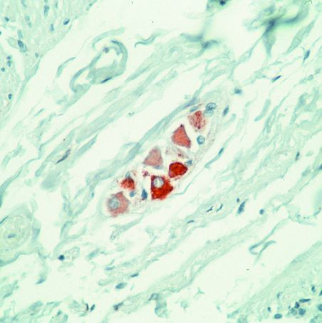 RET Antibody in Immunohistochemistry (IHC)